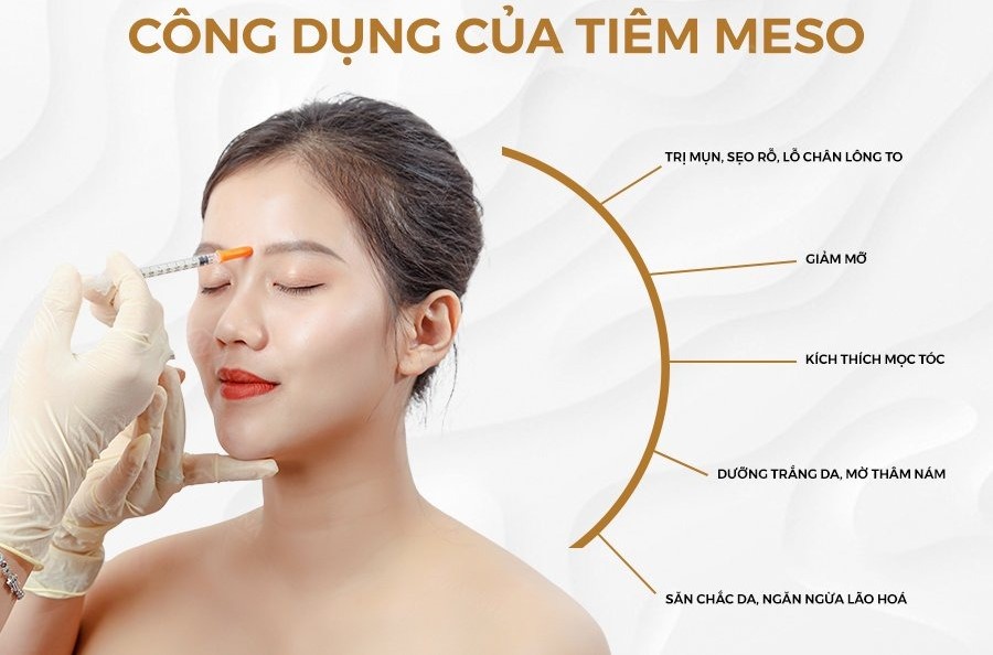 4 điều cần biết về tiêm meso trắng sáng